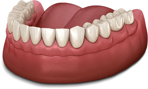 dentures model