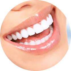 teeth whitening patient
