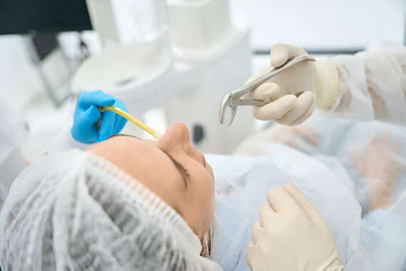 Tooth Extractions in Mississippi: What to Expect at Rowan Family Dentistry_FI