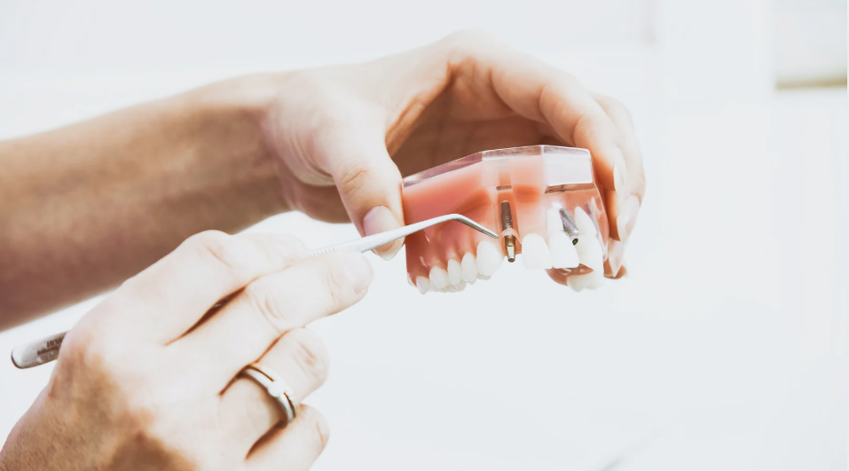 Aftercare for Single Dental Implants | New Albany, MS | Rowan Family Dentistry